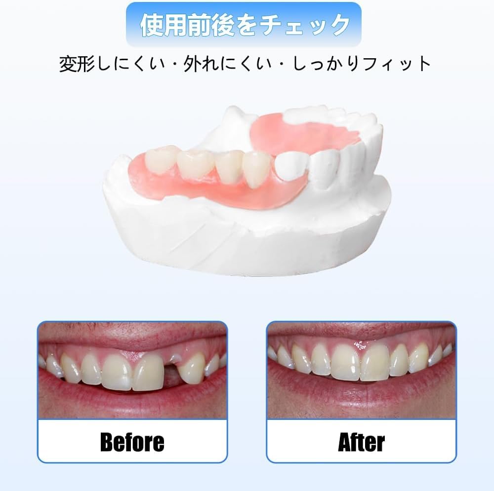 Amazon.co.jp: 4本 カスタム 入れ歯 部分 取り外し可能 Dentellea 義歯